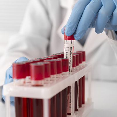 hse_0001_coronavirus-blood-samples-arrangement-lab